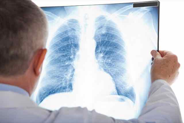 médico analisando uma radiografia de torax