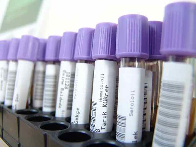 amostras de sangue