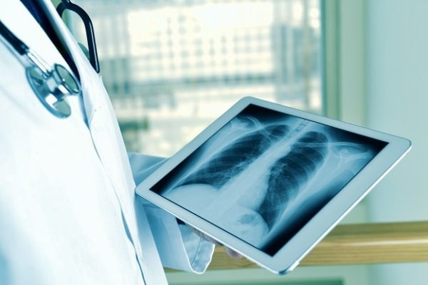 Manejo do derrame pleural benigno e maligno