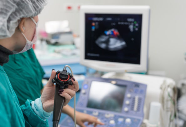 ecocardiograma
