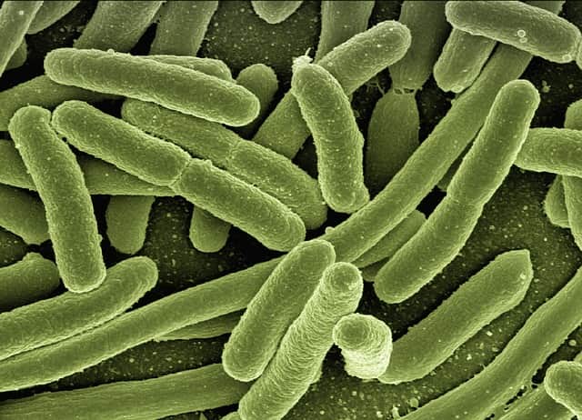 A bactéria Klebsiella pneumoniae carbapenemase foi encontrada na urina de 48 pessoas diagnosticadas com infecção urinária