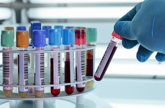 mão de laboratorista colocando tubo de sangue com hemólise para centrifugação