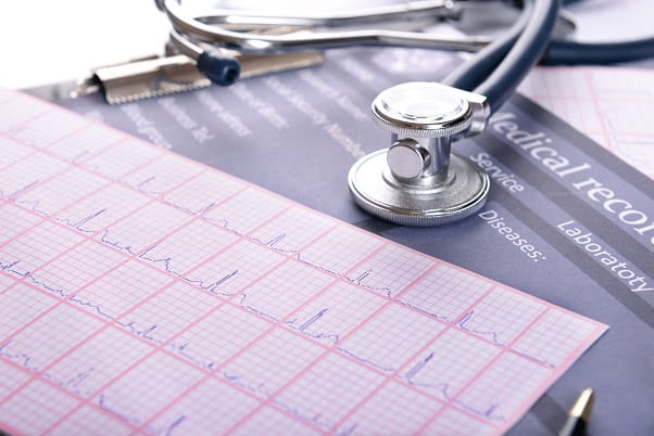 eletrocardiograma de paciente com ic descompensada