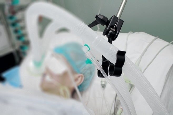 paciente com covid-19 internado em ventilação mecânica