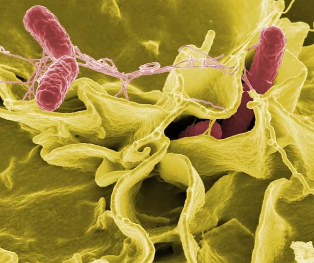 Exemplo gráfico de bacilos como a Mycobacterium tuberculosis sob efeito de corantes