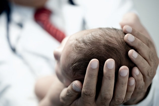 médico segurando cabeça de bebê com síndrome da abstinência neonatal