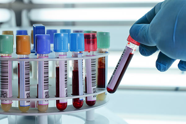 hemograma e divergências entre análises automatizadas e à microscópia óptica