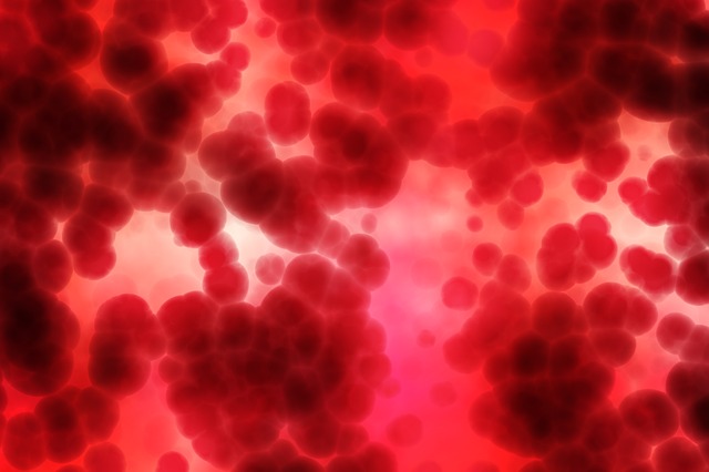 Trombocitopenia e trombose após vacina contra Covid-19