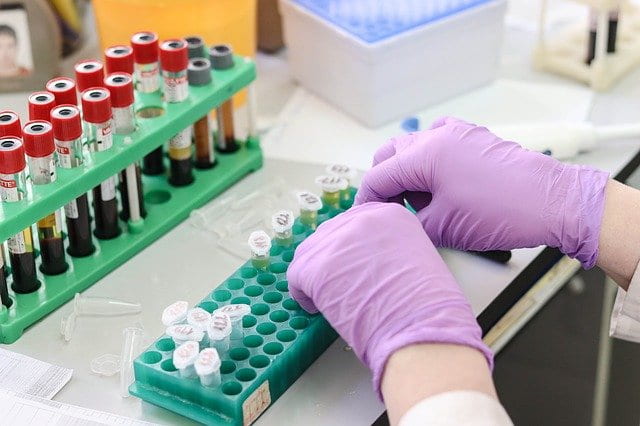 A possível interferência das crioaglutininas na série vermelha do hemograma