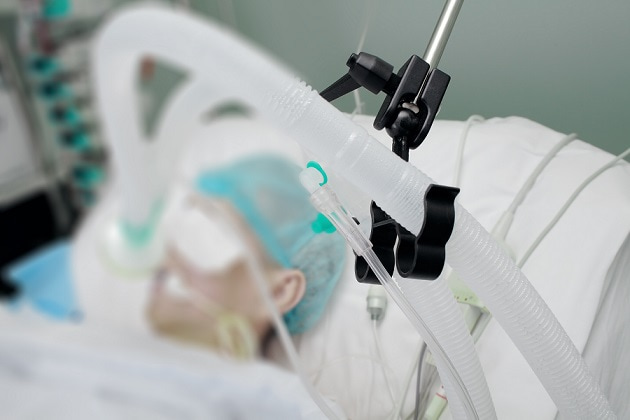 paciente em ventilação mecânica e hemodinâmica na sepse