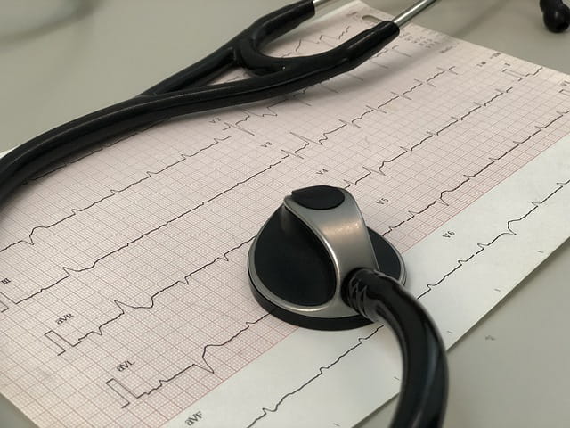 Quando iniciar anticoagulação após AVC relacionado a fibrilação atrial