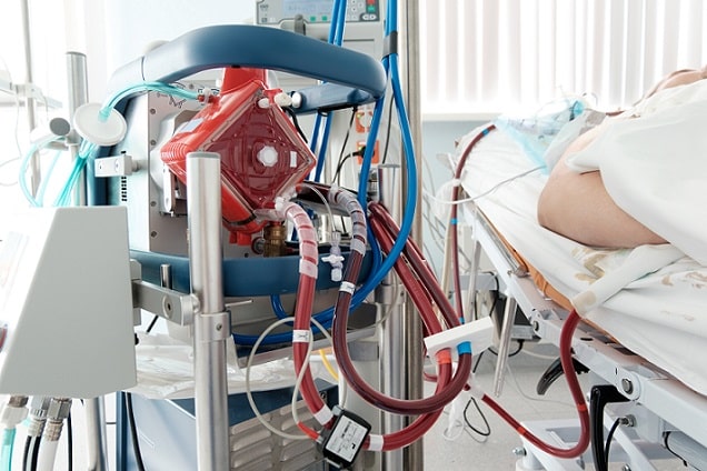 ecmo venovenosa