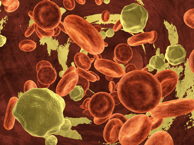 O uso de ferro por via intravenosa para o tratamento de anemia ferropênica é recomendado em muitas diretrizes clínicas devido à sua eficácia.