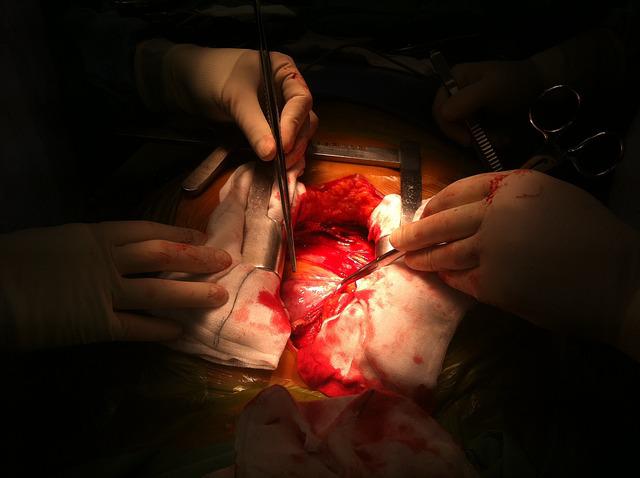 Qual o melhor momento para cirurgia cardíaca pós-infarto?