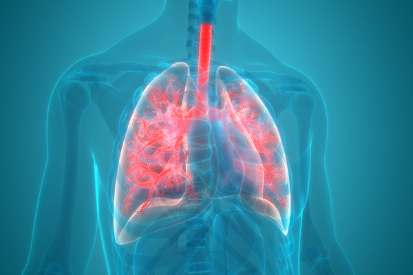 Pneumonia adquirida na comunidade grave