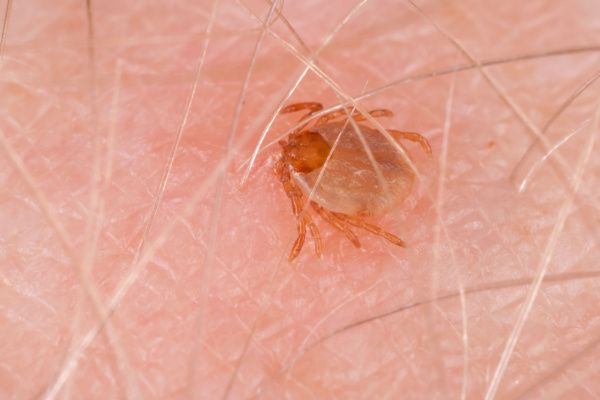 febre maculosa
