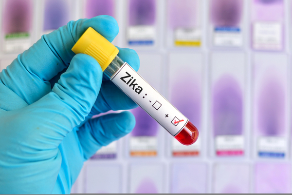 Butantan retoma desenvolvimento de vacina contra zika para gestantes