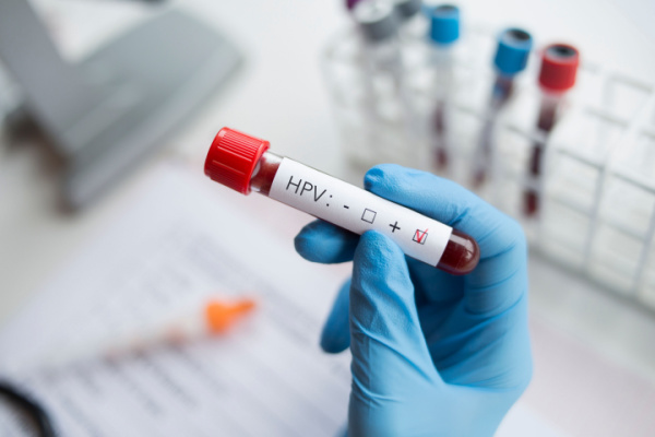 HPV